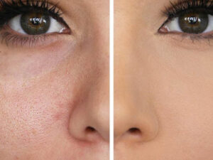 the ordinary toner 3