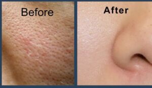 the ordinary toner 4