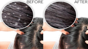 the ordinary toner 5