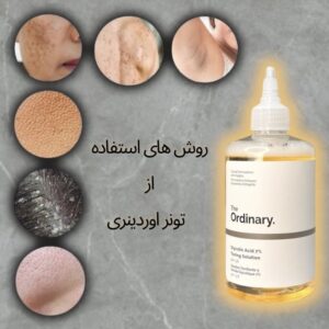 the ordinary tooner 2