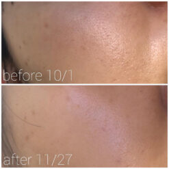 جوانساز و ضد چین و چروک رتینول 0.1 کوزارکس COSRX The Retinol 0.1 Cream 20ml 8