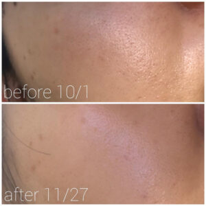 جوانساز و ضد چین و چروک رتینول 0.1 کوزارکس COSRX The Retinol 0.1 Cream 20ml 8